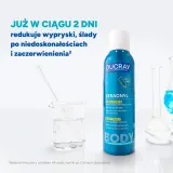 Ducray Keracnyl Anti-Blemish Drying Body Spray спрей для тела против несовершенств и высыпаний на спине, с салициловой и гликолевой кислотой 150 мл — фото 5