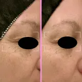 Регенерирующее сыворотка с ниацинамидом, фотолиазой и пептидами Lightinderm Repair, 2.1 мл — фото 4
