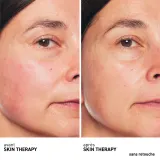 Erborian Skin Therapy Light двухфазная ночная сыворотка для лица — фото 2