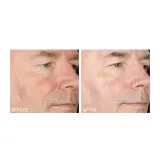 Ежедневный пилинг с интенсивной формулой Dr Dennis Gross Alpha Beta, оттенок 30 процедур — фото 2