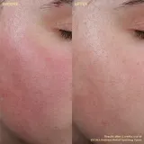 Крем для зрелой кожи лица, проблемная кожа BYOMA Redness Relief Soothing Toner, 100 мл — фото 2