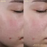 Крем для зрелой кожи лица, проблемная кожа BYOMA Blemish Clearing Paste, 15 мл — фото 3