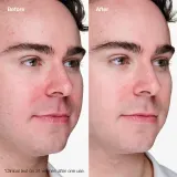 Clinique Anti-Blemish Solutions Clinical гель для лица от несовершенств 20 мл — фото 2