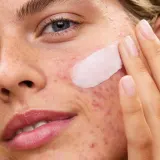 Бальзам для зрелой проблемной кожи с диметиконом First Aid Beauty Ultra Repair Rescue Balm, 63.7 г — фото 2