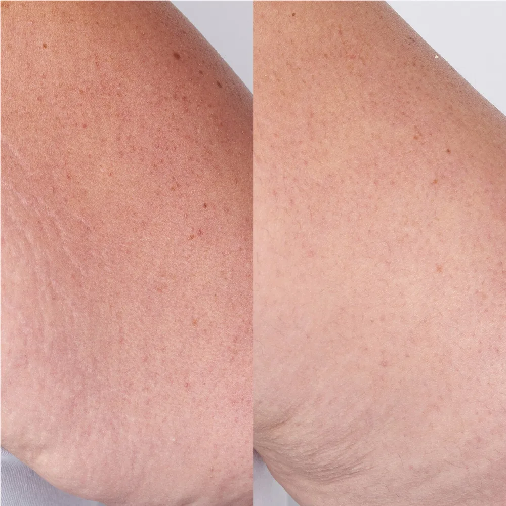 Sol de Janeiro Beija Flor Elasti-Body Oil масло для тела для эластичности кожи 100 мл