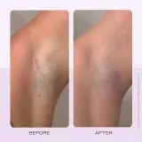 First Aid Beauty Ingrown Hair Pads диски против вросших волос, 60 шт, оттенок 60 PŁATKÓW — фото 4
