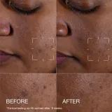 Clinique Even Better Clinical Dark Spot Clearing Serum сыворотка против пигментных пятен — фото 2