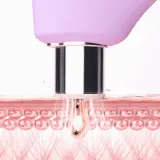 FOREO KIWI derma прибор для микродермабразии и очищения пор Lavender — фото 2
