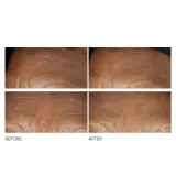 Интенсивный крем против морщин Dr Dennis Gross Advanced Retinol + Ferulic, 60 мл — фото 1