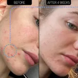 The Inkey List Blemish Clearing Moisturizer 2% NovoRetin ночной крем для лица, 50 мл — фото 3