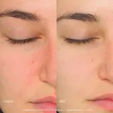 Пилинг для лица Dermalogica — фото 5