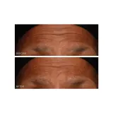 Сыворотка для лица, наполняющая и восстанавливающая Dr Dennis Gross DermInfusions, 30 мл — фото 3