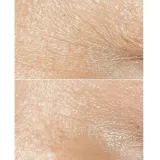 Clinique Smart Clinical Repair Wrinkle Correcting Rich Cream насыщенный крем для лица 50 мл — фото 2