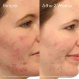 Очищающая пенка для лица Murad Clarifying Cleanser, 200 мл — фото 1