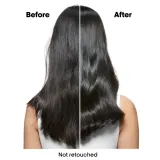 L'OREAL PROFESSIONNEL Scalp Advanced шампунь против перхоти для кожи головы 300 мл — фото 1