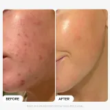 Paula's Choice The Plump and Glow Kit набор эксфолиант с 2% BHA и крем-гель с пептидами 30 мл + 15 мл — фото 1