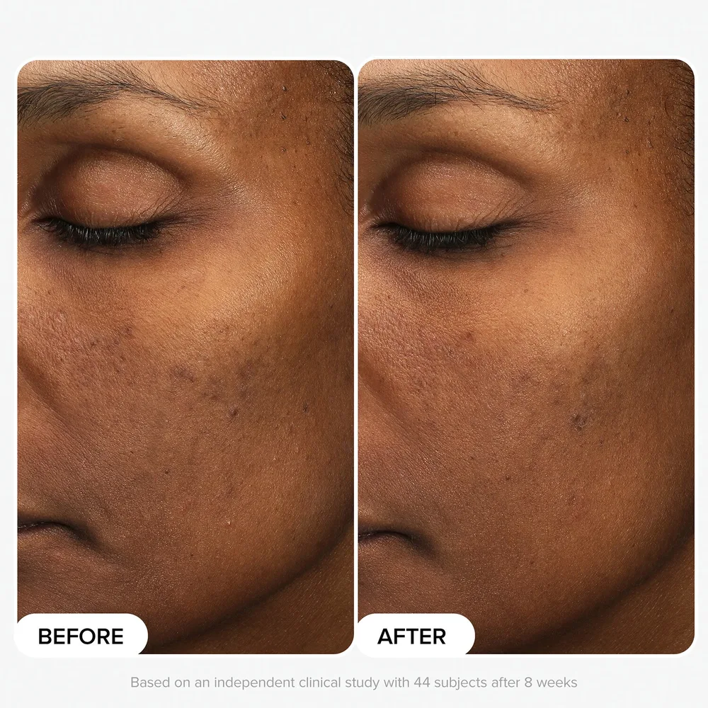 Paula's Choice Skin Perfecting отшелушивающий лосьон с 6% миндальной и 2% молочной кислотой 88 мл
