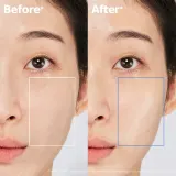 Aestura ATOBARRIER365 Cream крем для лица с церамидами — фото 1