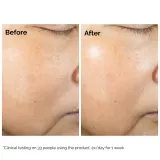 The Ordinary Rice Lipid Microemulsion Ectoine увлажняющая микроэмульсия для лица — фото 3