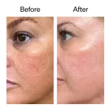The Inkey List Starter Retinol Serum сыворотка для лица с ретиноидами 30 мл — фото 2