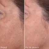 Murad Rapid Dark Spot Correcting Serum Сыворотка для лица 30 мл — фото 5