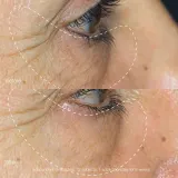 Dermalogica Awaken Peptide Eye Gel Гель для кожи вокруг глаз с пептидами 15 мл — фото 5