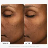 Paula's Choice Multi-Level Exfoliation Trial Kit Набор пилингов для лица AHA и BHA 30 мл + 30 мл — фото 2