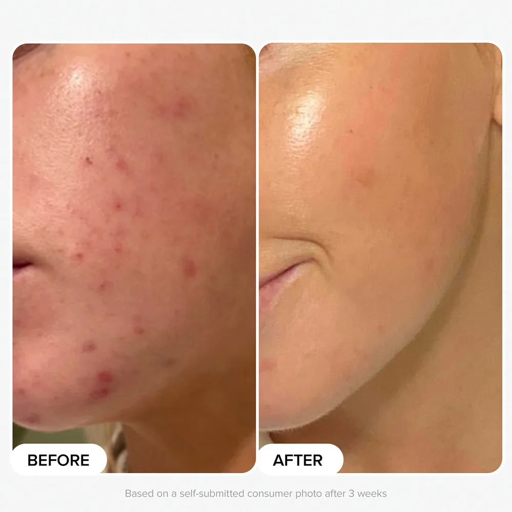Paula's Choice The Protect and Glow Kit набор для лица эксфолиант и дневной крем 30 мл + 15 мл