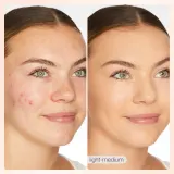 Tarte BB Blur тональный увлажняющий крем SPF 30, 30 мл, оттенок Medium — фото 1