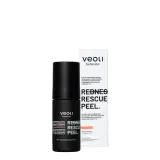 Пилинг для лица Veoli Botanica Redness Rescue Peel с кислотным комплексом 9% и центеллой 1%, для кожи с куперозом, 30 мл — фото 1