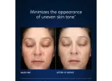 Крем для лица увлажняющий осветляющий PCA Skin Hydra Bright Cream, 50 мл — фото 2