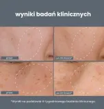 Система против пигментации: сыворотка и пилинг, 2 предмета Dermalogica — фото 7