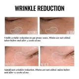 Крем для кожи вокруг глаз осветляющий, против отеков Instytutum Truly-Transforming Brightening Eye Cream, 15 мл — фото 3