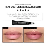 Омолаживающая сыворотка-бальзам для губ Revision Skincare, 9,4 г — фото 6
