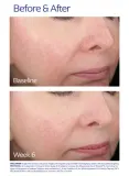 Сыворотка для кожи со склонностью к покраснениям ZO Skin Health, 20 мл — фото 7