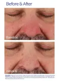 Сыворотка для кожи со склонностью к покраснениям ZO Skin Health, 20 мл — фото 8